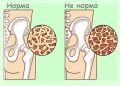 Как укрепить свои кости после 55: секреты здоровья, которые вы могли упустить