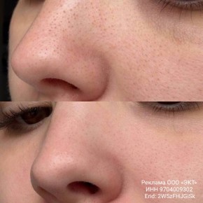 Стремитесь к идеальной коже? Откройте секрет энзимной пудры