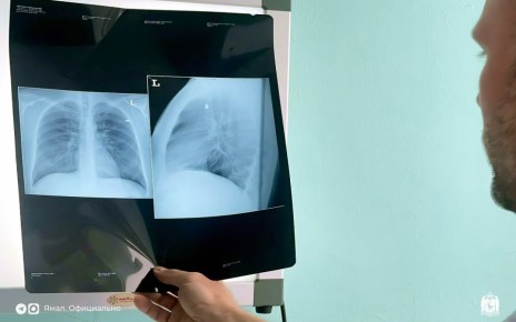 ���������� ������������ ������� ������� �� ������� ������ �����