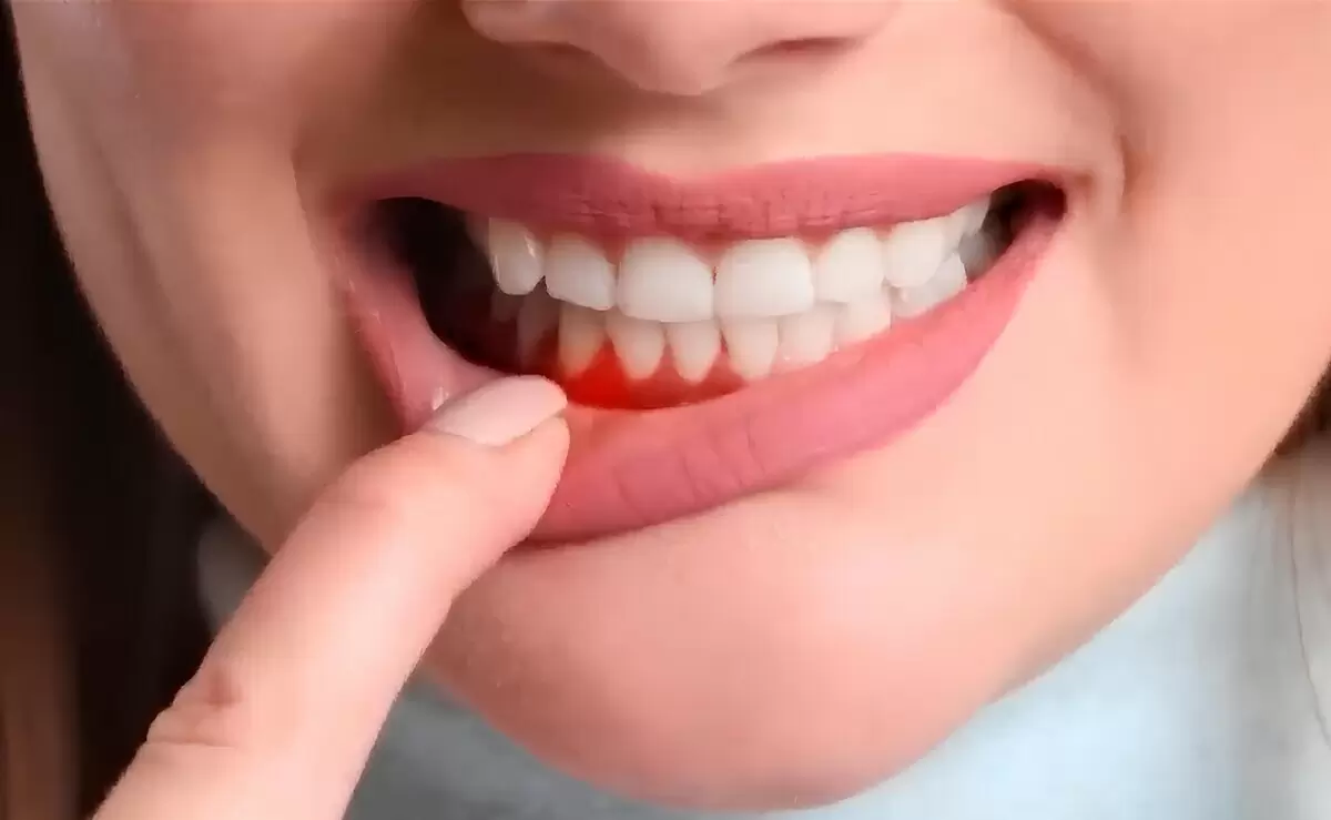 Как правильно ухаживать за зубами после профессиональной чистки: советы стоматолога