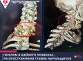 В Новом Уренгое пенсионер сломал шею во время купания