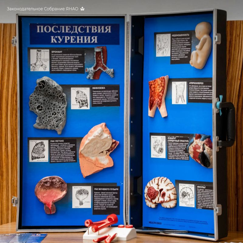 Ямал выбирает здоровье: бесплатный медицинский экспресс-чекап в парламенте Ямал выбирает здоровье: бесплатный медицинский экспресс-чекап в парламенте