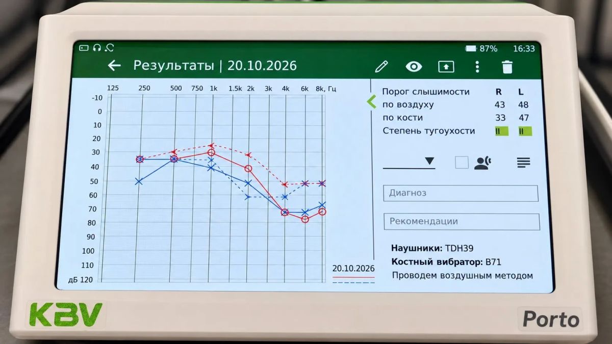 В Год здоровья в пяти ямальских больницах установили новое сурдологическое оборудование В Год здоровья в пяти ямальских больницах установили новое сурдологическое оборудование